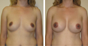 Before & After Photos
